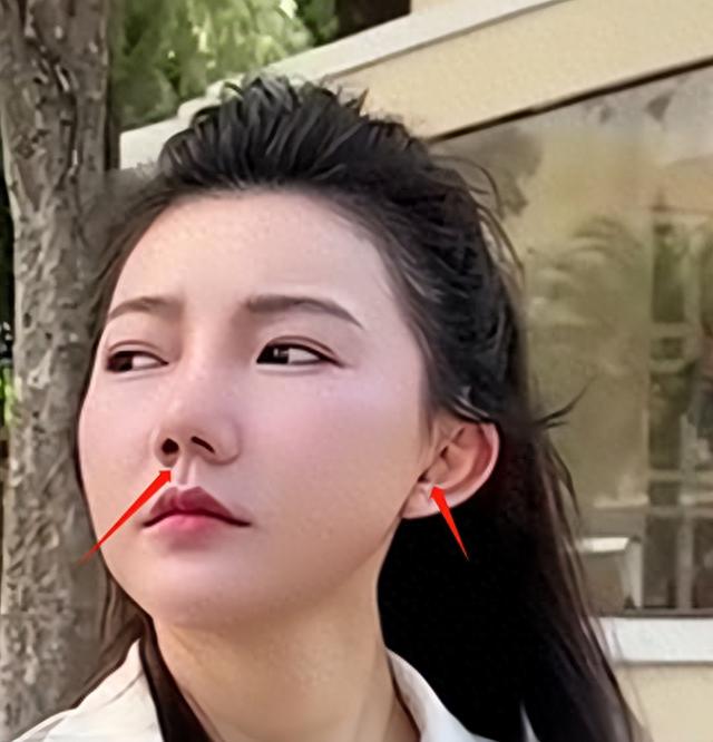 中华小姐回应牙齿被拔光,穿赵露思同款衣服摆拍,耳朵被割戴假耳