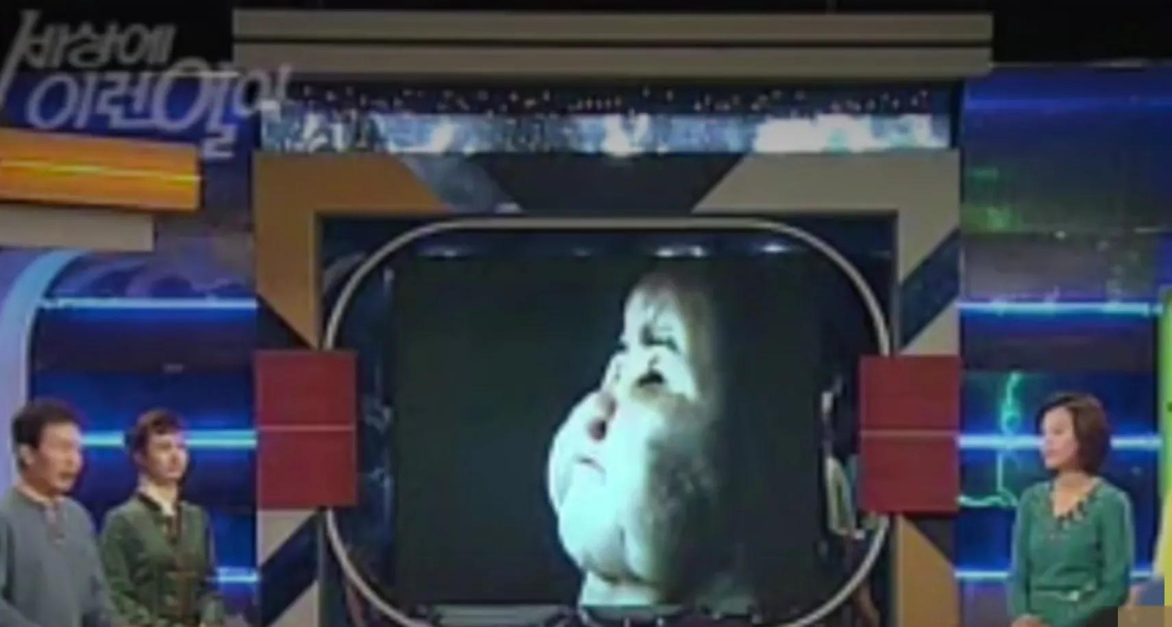 韩慧景|28岁女歌星整容成瘾!缺钱整容自己动手