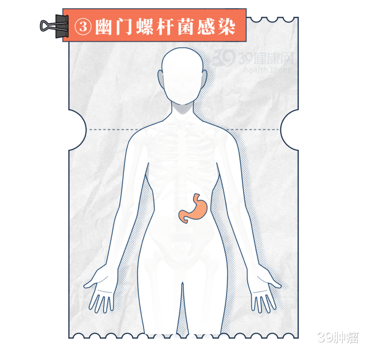 柳叶刀：幽门螺杆菌是中国胃癌的“罪魁祸首”，3点帮你彻底根除
