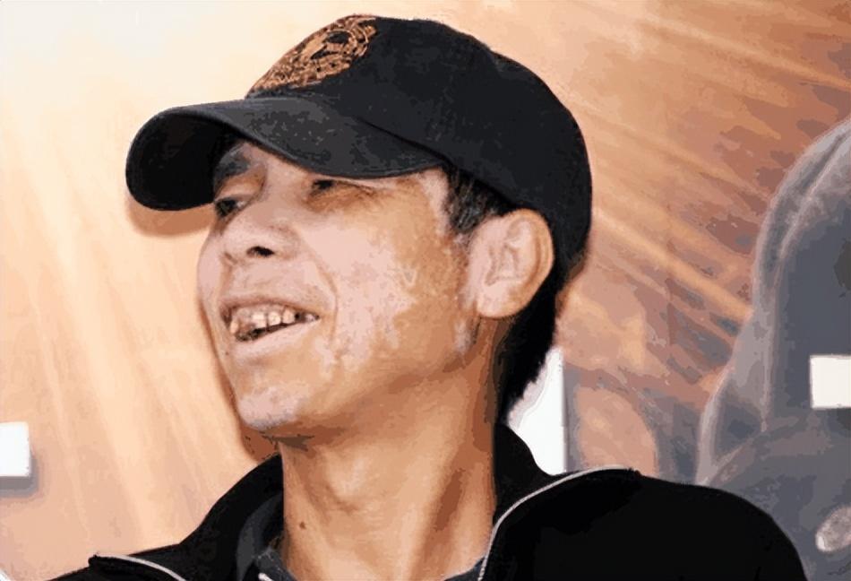 口水能过敏，天生没子宫，这6位明星的“隐疾”，有钱也治不好