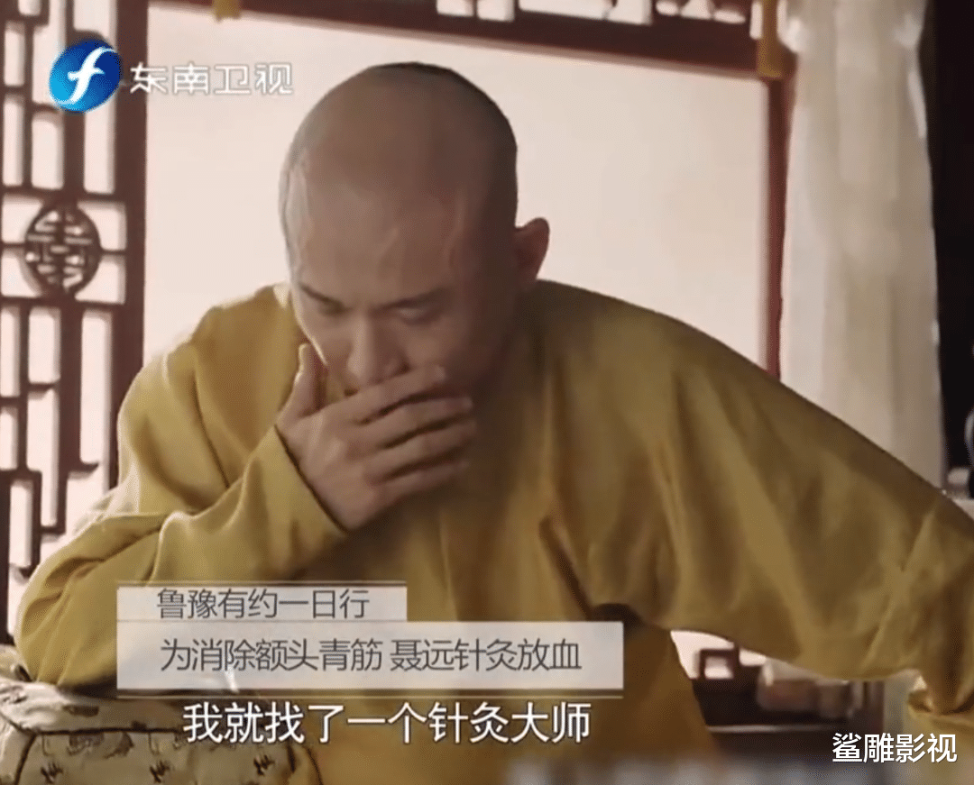 黄晓明为治秃头,花了多少冤枉钱