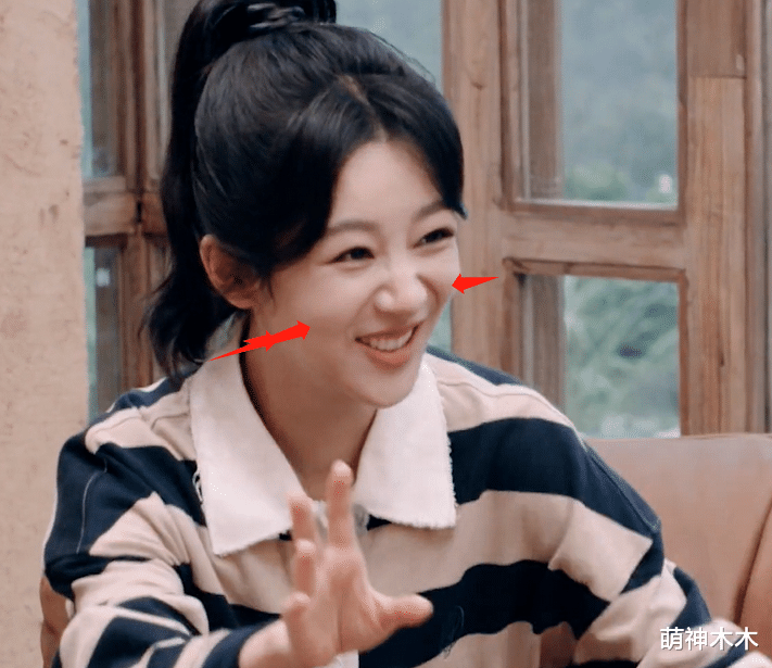 杨紫综艺上线暴露状态，法令纹夸张下巴变尖，网友吐槽医美后遗症