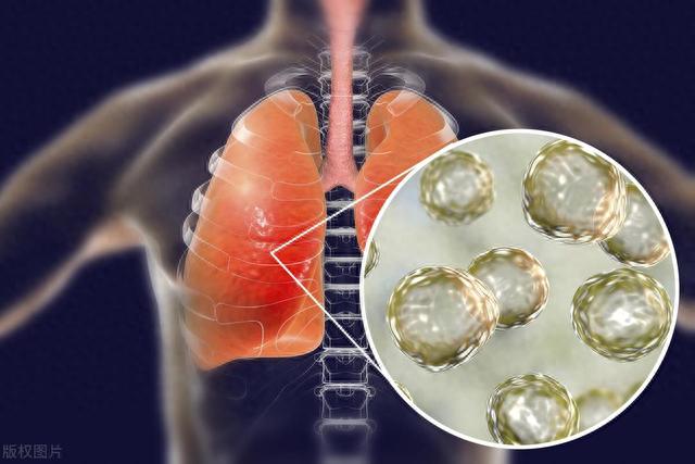 “三阳”了更要懂得忌嘴，提醒大家：少吃发物，多吃这4样可排毒