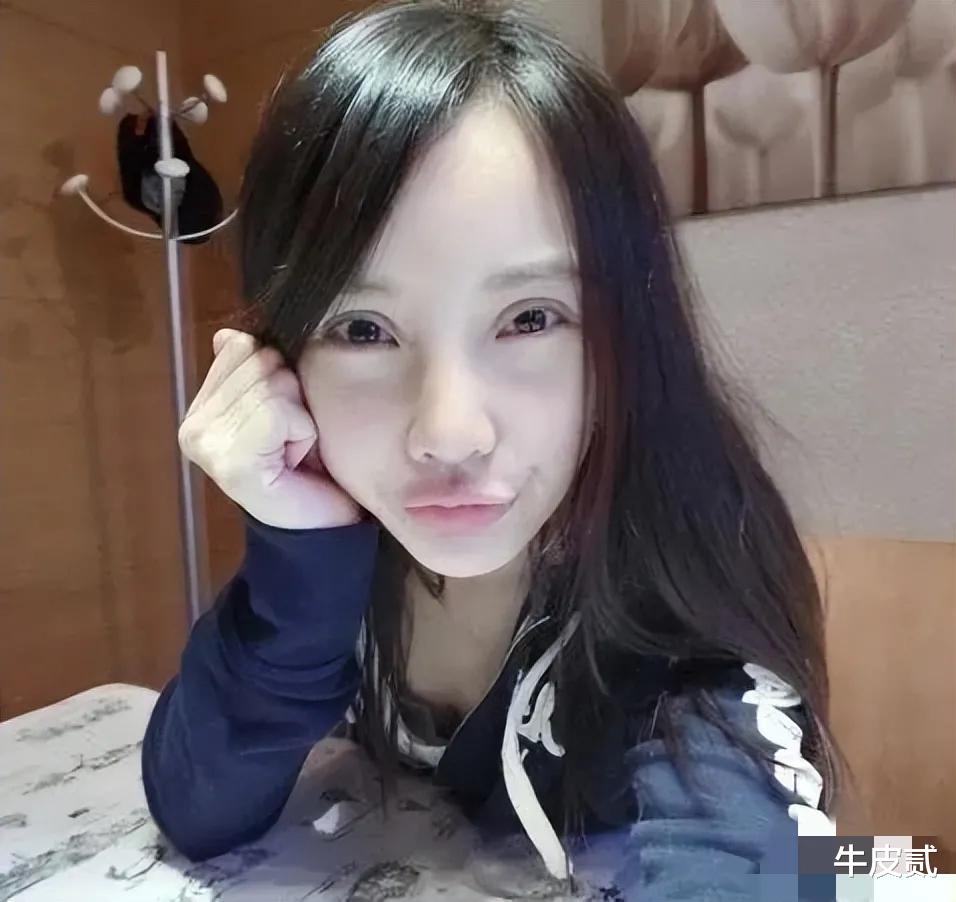 整容|有种倔强叫“我没整容”！明明从大饼脸变成V脸，真当观众瞎吗？