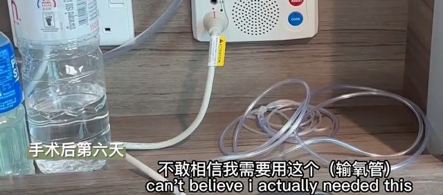 李玟|李玟手术成功!懒理婚变重新学走路,整条腿贴满绷带委屈落泪