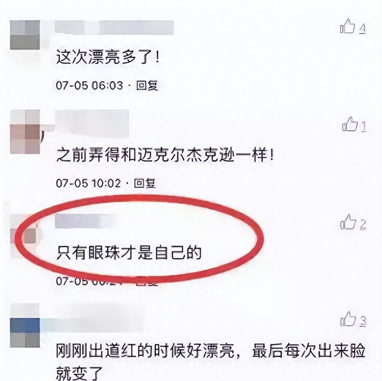 曾是超女冠军,却因整容失败像“怪物”,全身只剩下眼珠是自己的