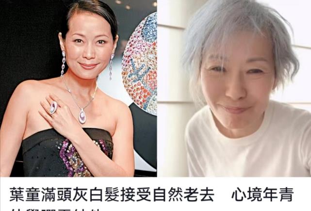 69岁赵雅芝对比60岁叶童,自然老去和医美老去的差距一目了然