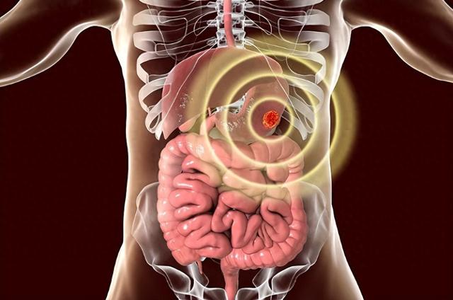 体内有癌，吃饭先知？忠告：吃饭时出现这4种异常，警惕身体警报