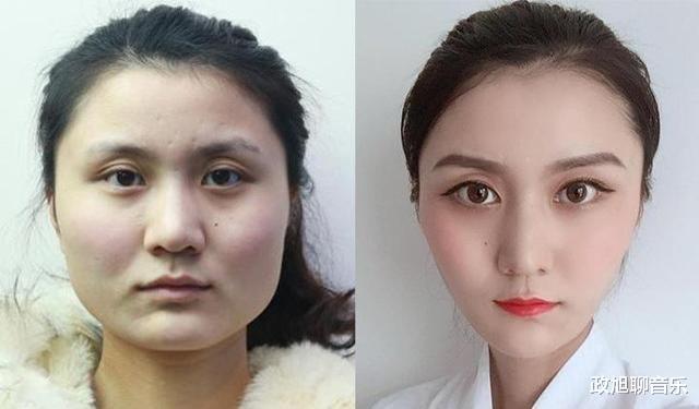 那些削过骨的女星怎样了？后遗症多不多？看看杨幂的脸就知道了