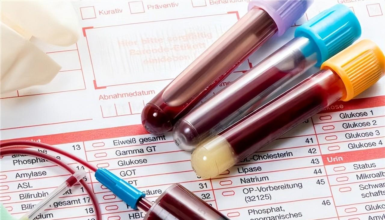 脑积水|40岁男子痛风发作，查出肾衰竭，提醒：2种食物加速恶化，管住嘴