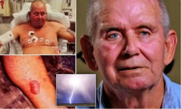 闪电的威力有多大?人被雷电击中后,身体会发生什么变化?