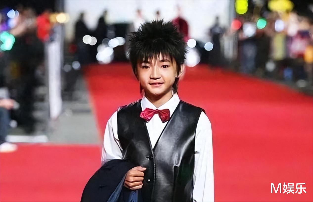 被注射抑生长剂，皮肤溃烂无人管，这4位童星，真的被父母害惨了