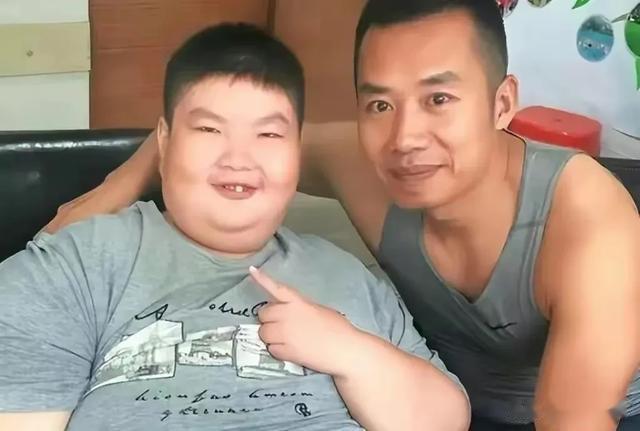 14岁男孩一顿吃18包泡面，体重300斤，去世前每个毛孔都在流水