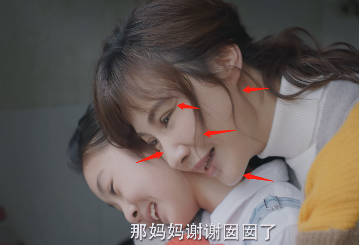 当微笑唇、硅胶脸混进都市剧,高颜值被打回原形,演技再好也拉胯