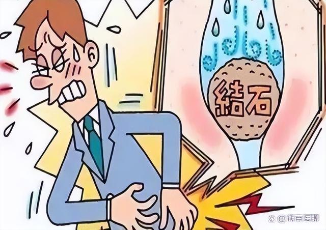 疼得要命?排尿困难?一个周末解决体内小炸弹,利尿又排石