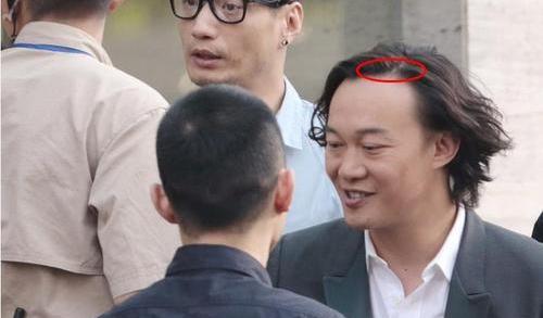 周杰伦 白敬亭、周杰伦头顶稀疏，原来男星早就秃了，观众被骗惨了