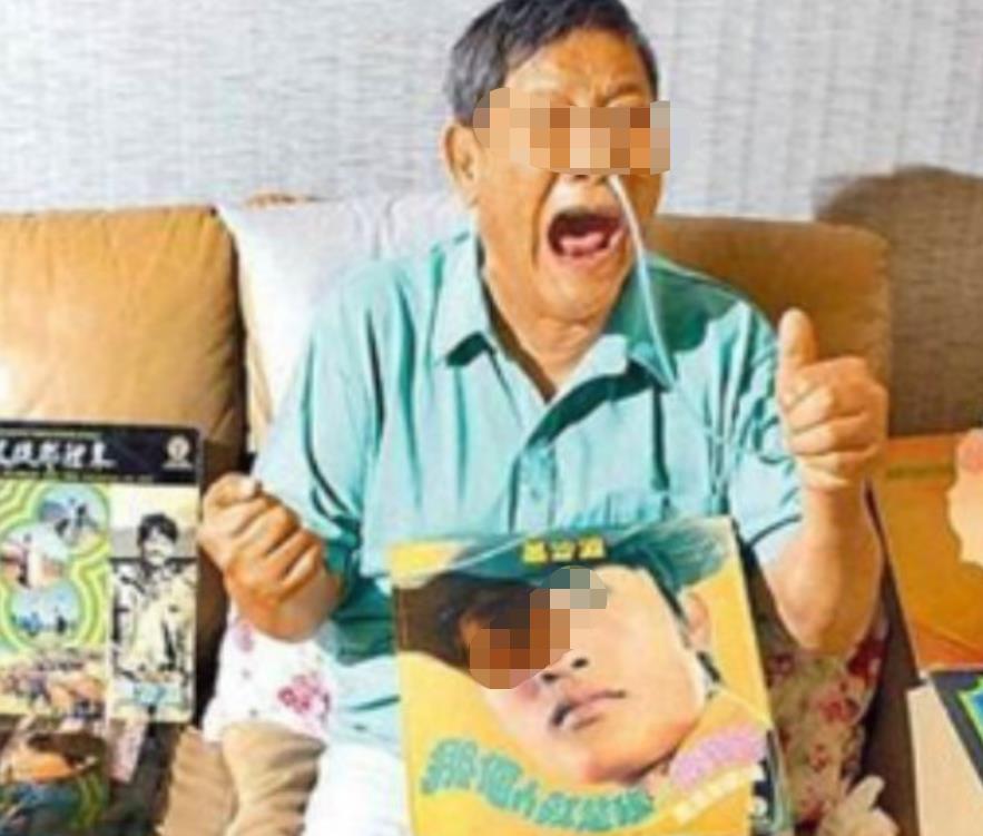 春晚|春晚一夜成名,意外坠楼成“智障”,被妻女抛弃,情人照顾他21年