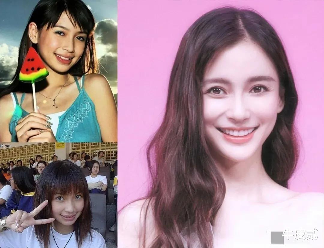 整容|有种倔强叫“我没整容”！明明从大饼脸变成V脸，真当观众瞎吗？