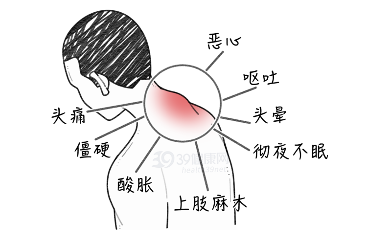 肿瘤|体内有癌，脖子先知？颈部若出现5种异常表现，可能是癌症在靠近