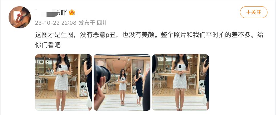 赵今麦活动生图小腿外翻有很多疤痕，穿恨天高也挽救不了身材比例