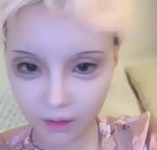 整容|迪丽拉：为变“真人芭比”疯狂整容，面部僵硬，卸妆后像“鬼”