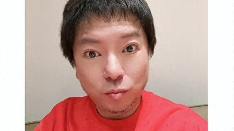 53岁高晓松暴瘦到认不出，剪短发瓜子脸似华晨宇，被疑是做医美想复出