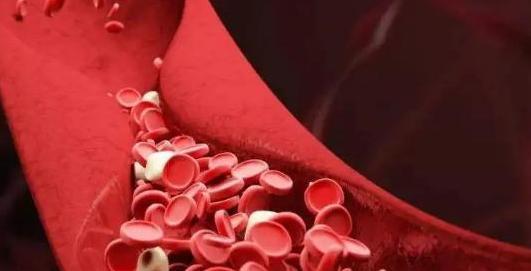 胆固醇|晨起是降脂“黄金期”，提醒：多吃5种早餐，血脂或会“蹭蹭降”