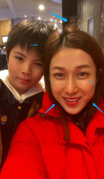 39岁钟嘉欣加拿大街头被偶遇,生图曝真实状态,断发严重脸不对称