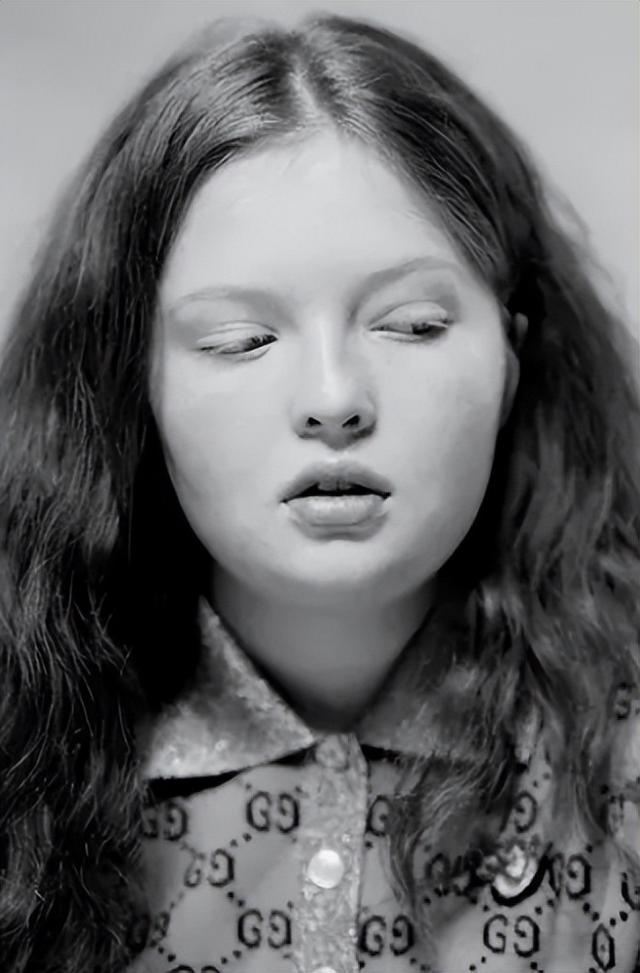 超模|21岁美国超模:体重200斤,一脸雀斑还有双下巴,却比卡戴珊还美