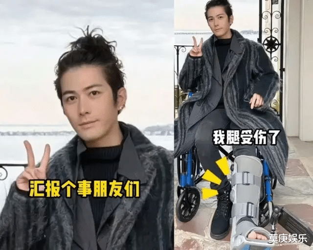 知名男星车祸后第三次手术,静躺病床满腿伤疤,头发全白浑身插管