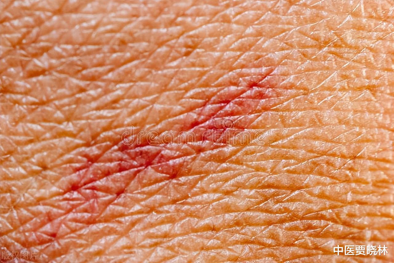 六君子|疫情过后，越来越多人查出肺结节？分享一个奇效良方，专治肺结节