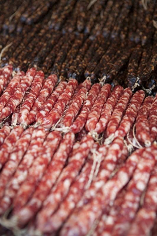 女子连吃一周腊肠致左眼近乎失明，主治医生：其为20年糖尿病患者，已接受手术治疗