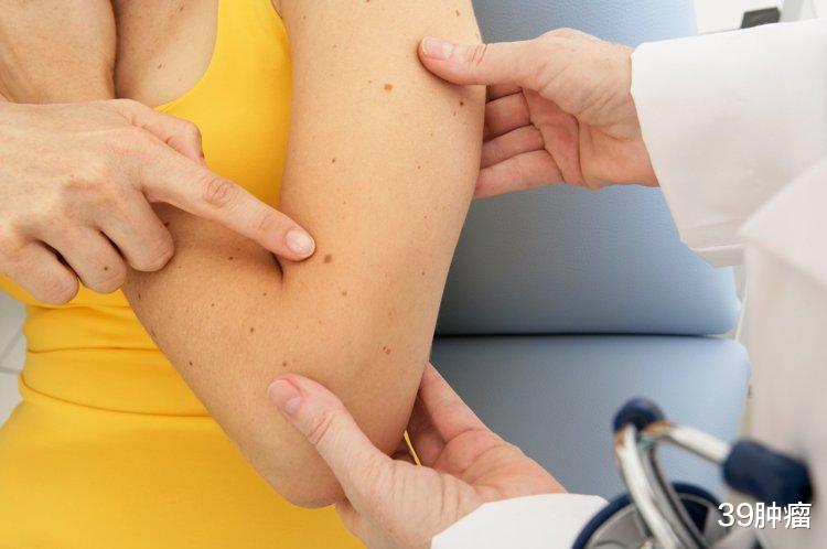 肺癌|中国一年有457万人确诊癌症!身体出现6个异样,癌症可能已经来临