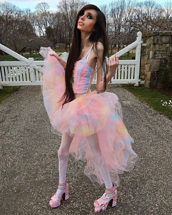 是愚蠢还是厌食？美国一网红以廋成名，瘦骨嶙峋，像纸片人一样