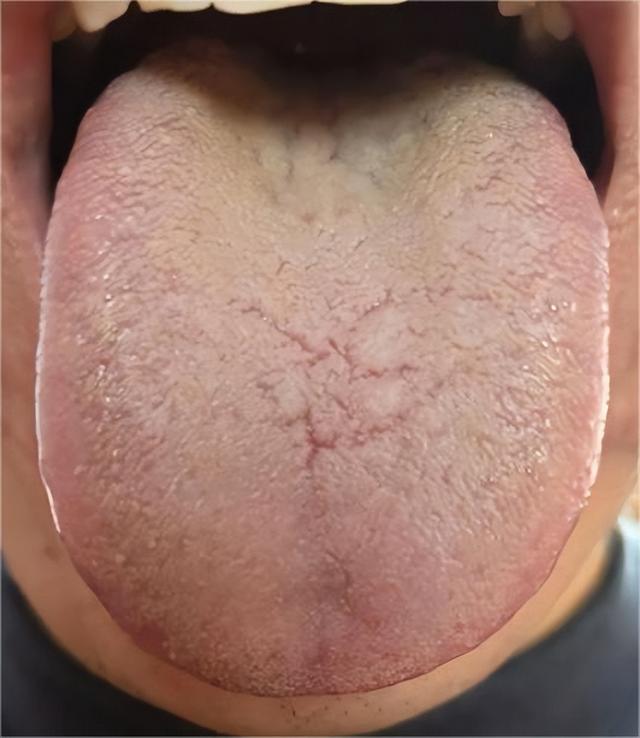 都是疏肝名药 柴胡舒肝丸、逍遥丸、龙胆泻肝丸到底哪个疏肝更好？