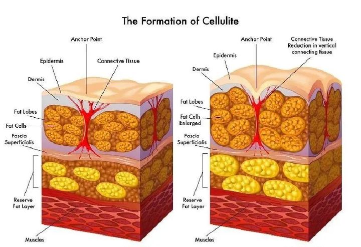 减肥小知识:除了茄子,这些食物也很容易吸油长胖哦~