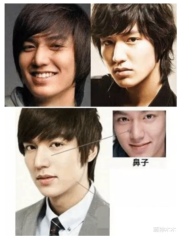 李敏镐最新生图不敢认!脸颊胖到像气球,疑似整容后遗症爆发