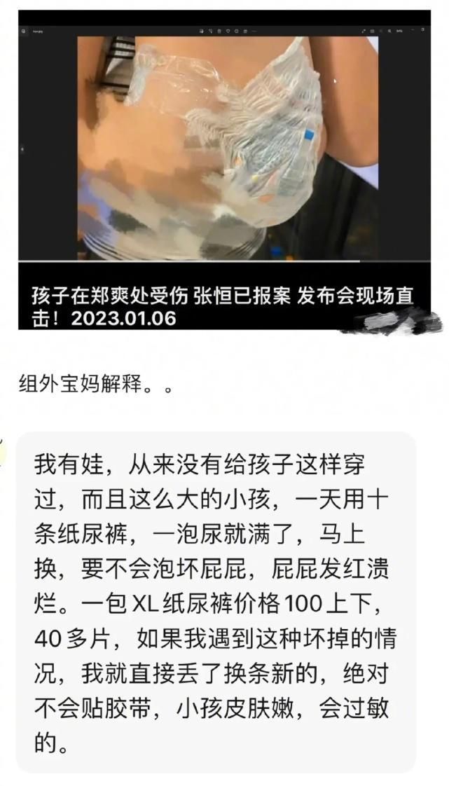 郑爽|郑爽晒近照反击，故意遮挡发际线，身后家具破旧在国外生活条件差