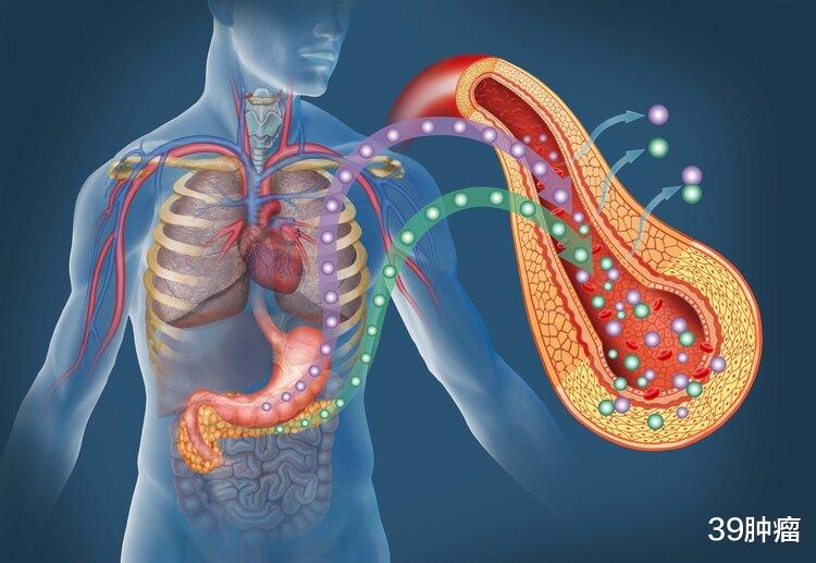 “癌王”胰腺癌，很多人误以为是胃病！出现5个症状，及时就医
