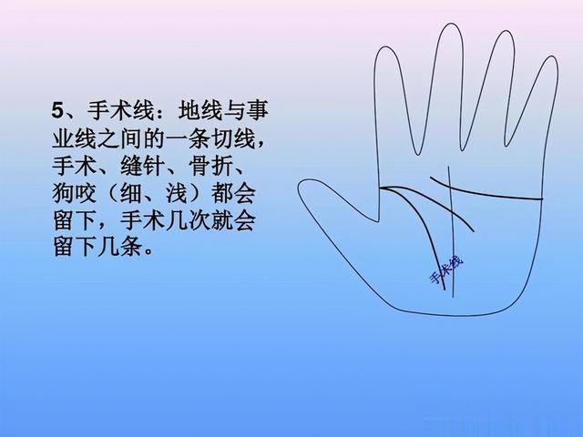 最全手诊图谱,一看就懂,简单实用!不出门也能望手察病!收了吧