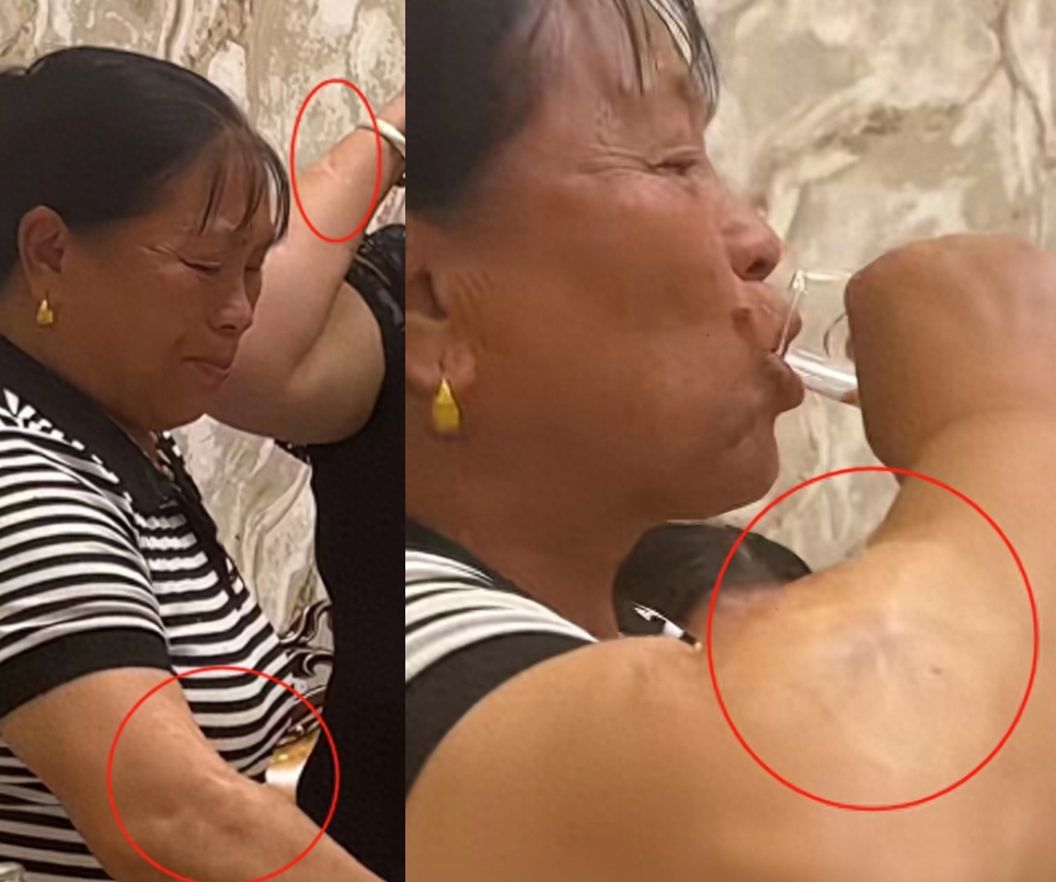 柬埔寨依晴自曝园区上位史，与“梅姨”狂拼酒，胳膊刀疤暴露身份