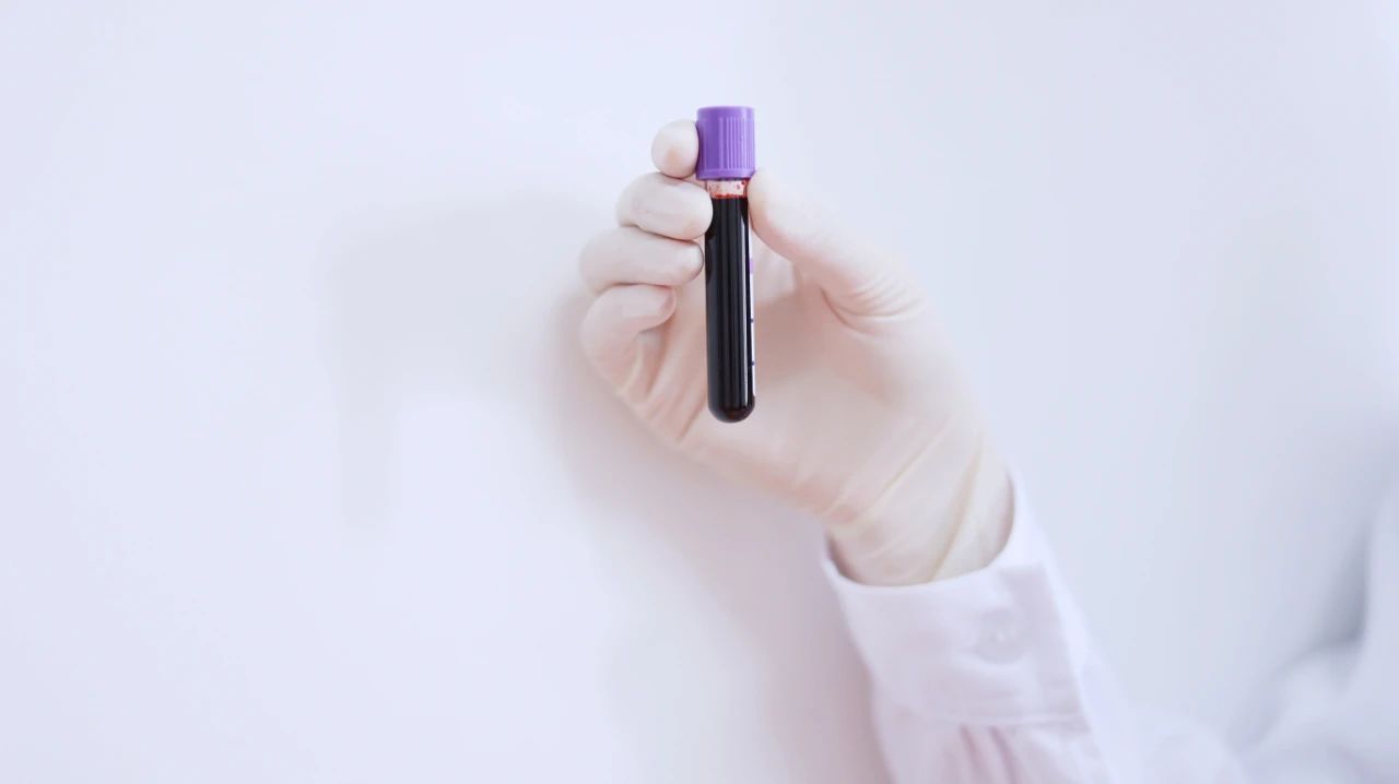 脑梗是因为缺少叶酸?提醒:不想脑梗“上门”,这5种食物要少吃