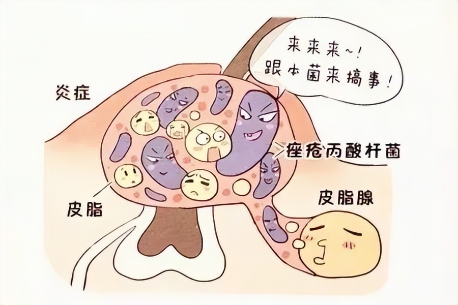 减脂 护肤骗局:不洗脸就是最好的护肤