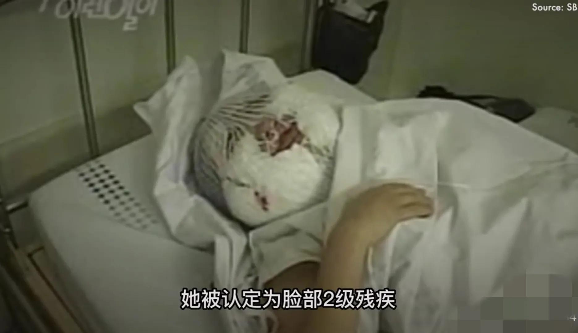 韩慧景|28岁女歌星整容成瘾!缺钱整容自己动手:脸上注射香油和水泥!