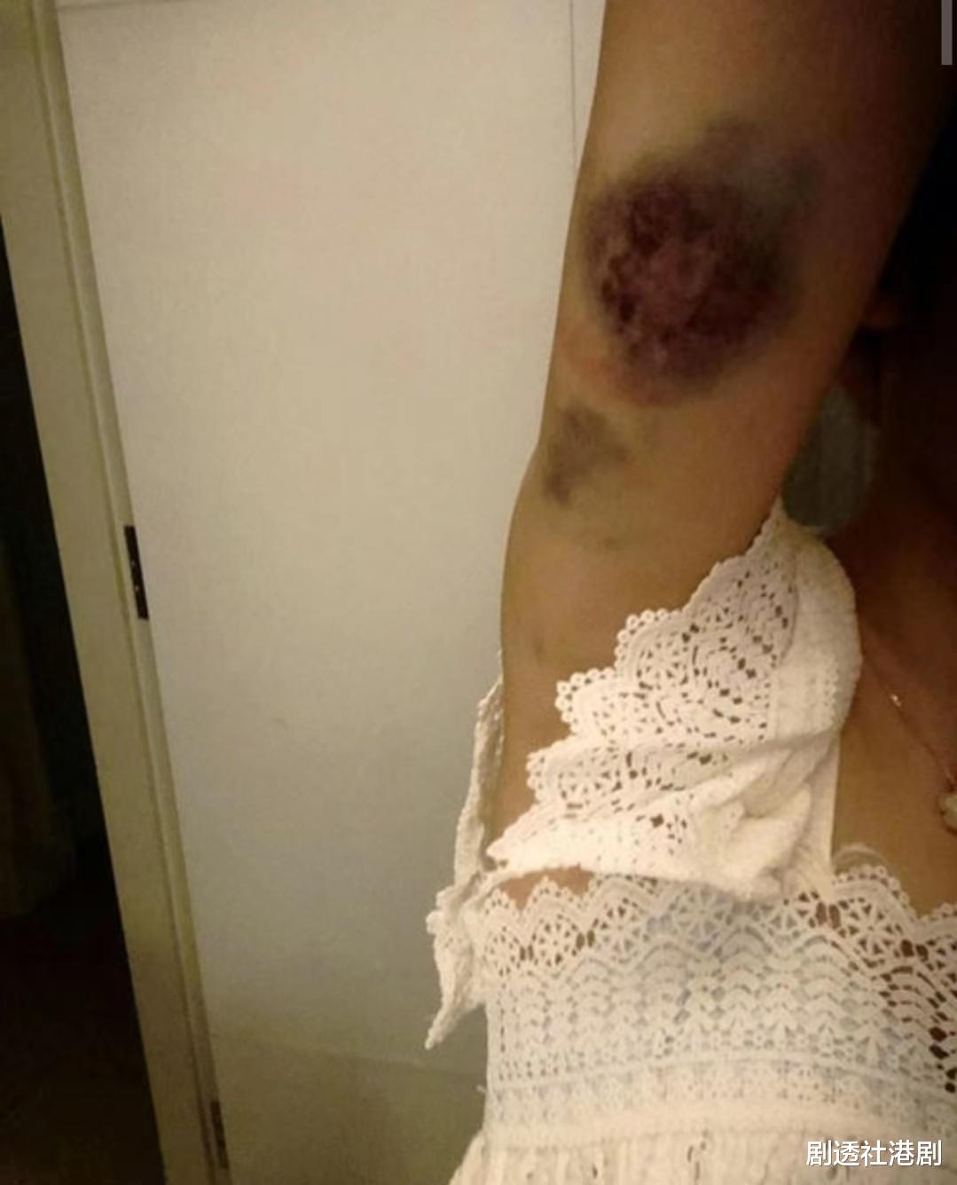 TVB|曾因感情事闹上警局!TVB前小花近况发福明显,曾被称清纯版张柏芝