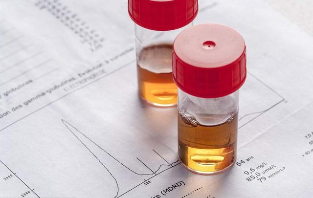 豆腐是高尿酸的死穴?医生提醒:少吃这5种食物,尿酸高不了