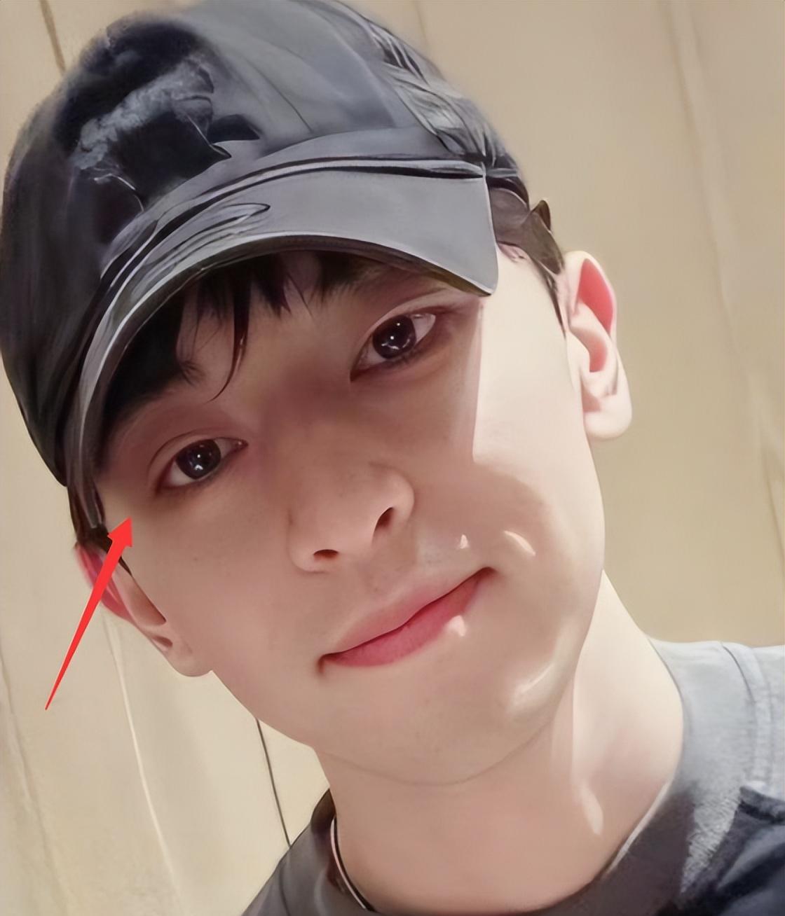 邓伦|邓伦近照大变样，疑整容变双眼皮，与圈内明星一起参加婚礼成焦点