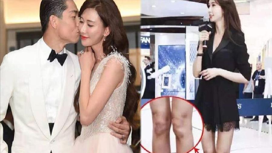 林志玲近照曝光大变样，48岁身材臃肿似大妈，4年来依旧卑躬屈膝