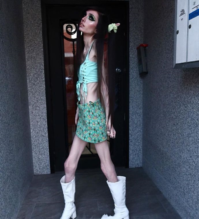 是愚蠢还是厌食？美国一网红以廋成名，瘦骨嶙峋，像纸片人一样