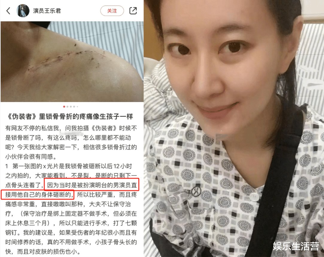 伪装者女主控诉被胡歌砸断锁骨,嘲讽他越混越差,采访视频太打脸